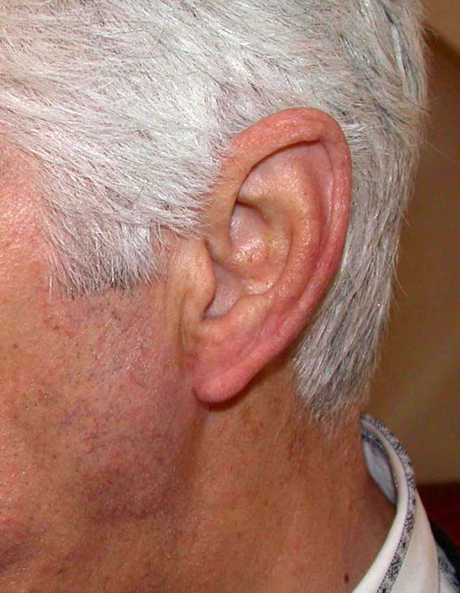 oreilles 01