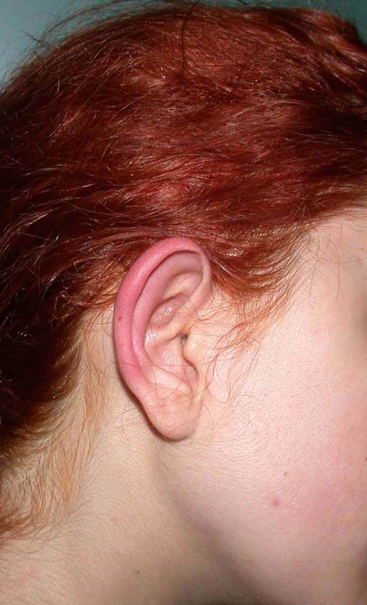 oreilles 02