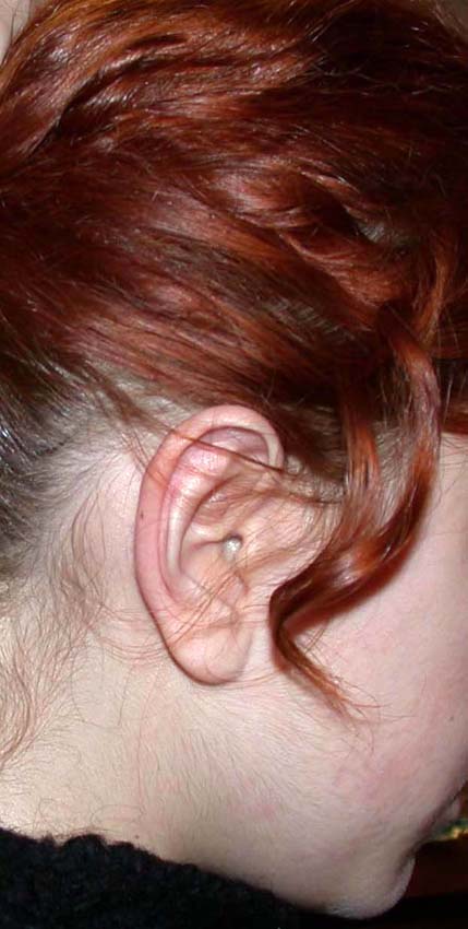 oreilles 03