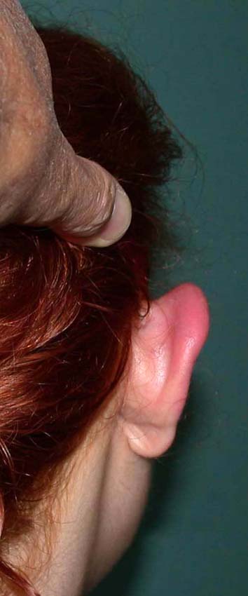 oreilles 06