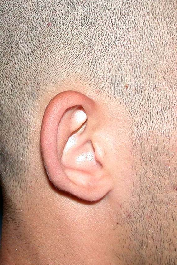 oreilles 10