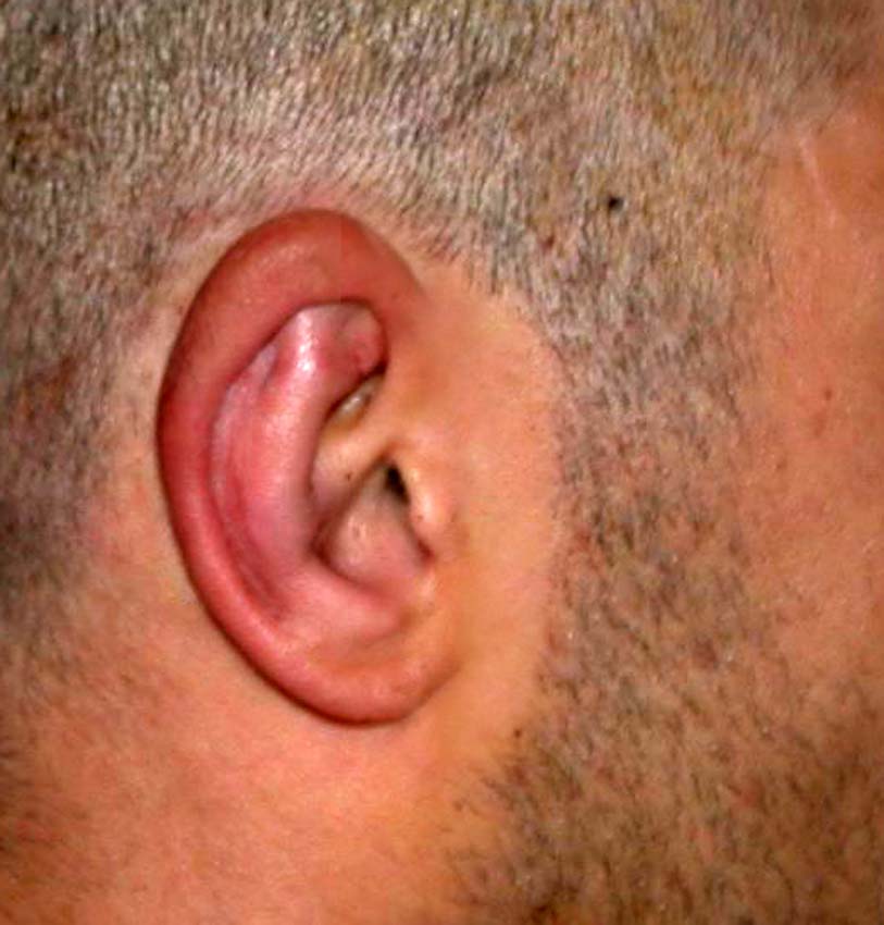 oreilles 11